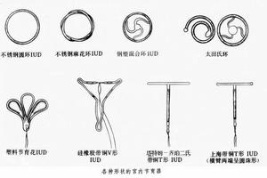 晋江取避孕环疼吗(取避孕环手术多少钱疼吗)