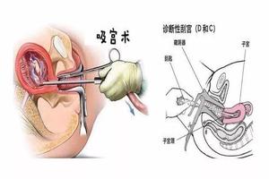 晋江药流需要准备什么(做药流需要准备什么证件)