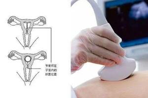 晋江取环能怀孕吗(取环能取干净吗)