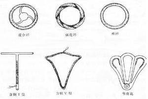 晋江环上环(泉州上环多少钱)